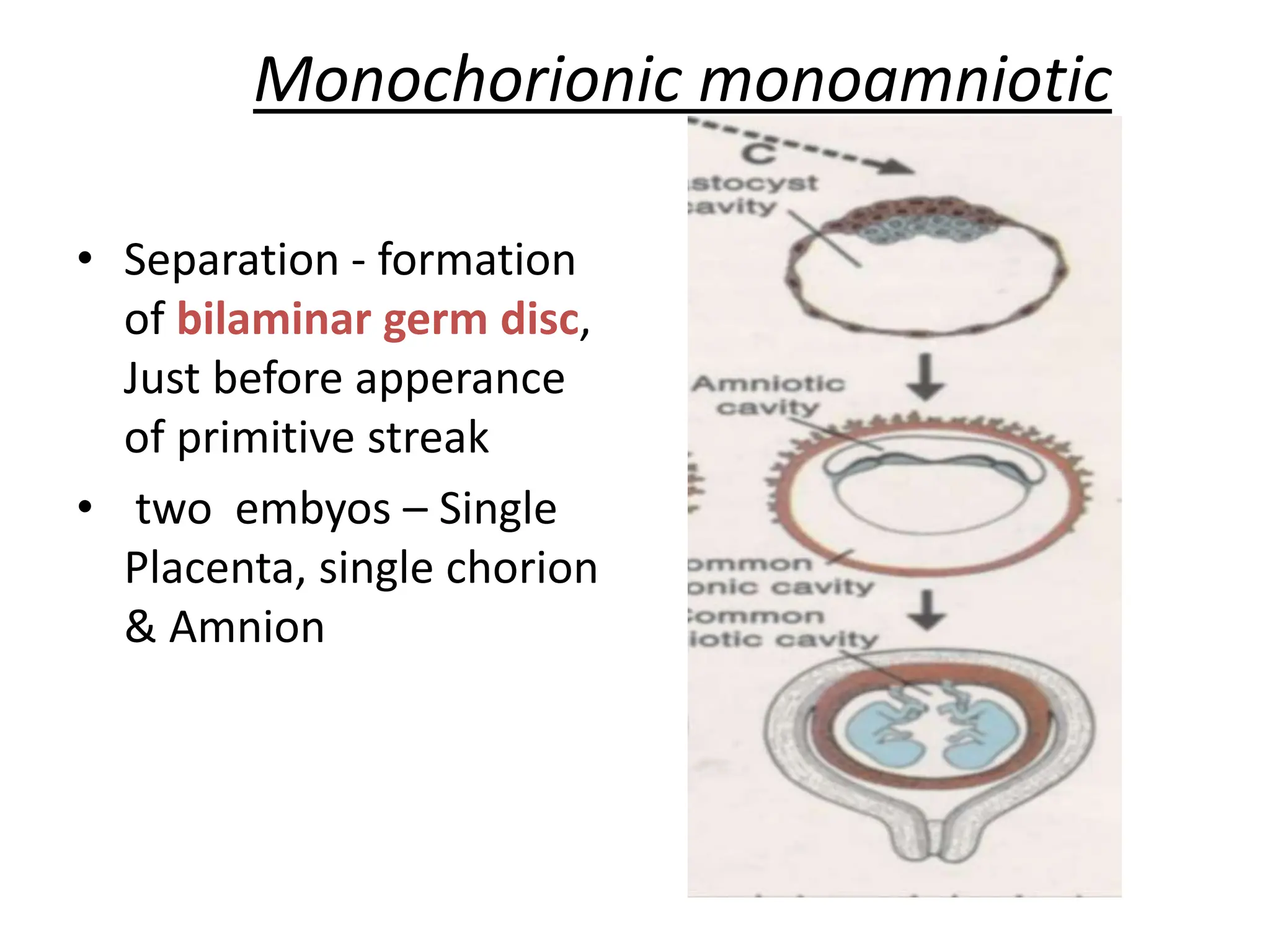 Monochorionic monoamniotic
• Separation - formation
of bilaminar germ disc,
Just before apperance
of primitive streak
• two embyos – Single
Placenta, single chorion
& Amnion
 