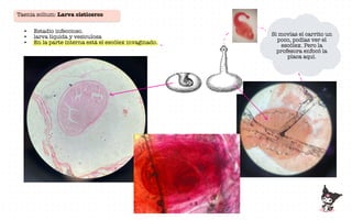Taenia solium: Larva cisticerco
• Estadio infeccioso.
• larva líquida y vesiculosa
• En la parte interna está el escólex invaginado.
Si movías el carrito un
poco, podías ver el
escólex. Pero la
profesora enfocó la
placa aquí.
......
-
7
"
i
L
1
!
 