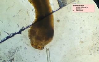 Taenia solium
• Doble cadena de
ganchos.
• Ventosas.
 
