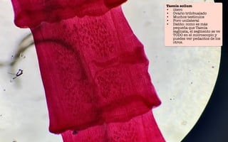 Taenia solium
Taenia solium
• útero
• Ovario trilobualado
• Muchos testículos
• Poro unilateral
• Datito: como es más
pequeña que Taenia
saginata, el segmento se ve
TODO en el microscopio y
puedes ver pedacitos de los
otros.
 