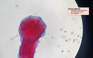 Taenia saginata
• Escólex cuadrangular o
en forma de puño.
• Sin rostelo.
 