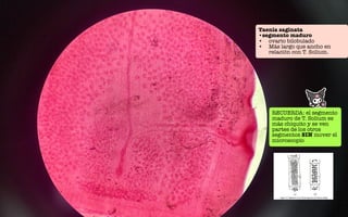 Taenia saginata
•segmento maduro
• ovario bilobulado
• Más largo que ancho en
relación con T. Solium.
RECUERDA: el segmento
maduro de T. Solium es
más chiquito y se ven
partes de los otros
segmentos SIN mover el
microscopio
 