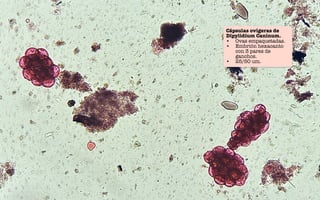 Cápsulas ovigeras de
Dipylidium Caninum.
• Ovas empaquetadas.
• Embrión hexacanto
con 3 pares de
ganchos.
• 25/50 um.
 