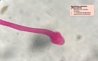 Dipylidium caninum.
(Placa móvil)
• Escólex con rostelo
armado.
• 1-7 hileras de ganchos.
• Apariencia romboidea.
 