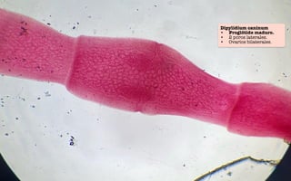 Dipylidium caninum
• Proglótide maduro.
• 2 poros laterales.
• Ovarios bilaterales.
 
