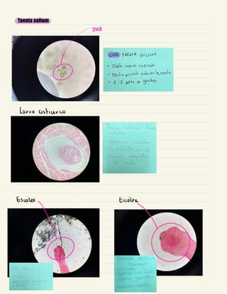 Taenia solium
~ora
larva cisticerco
Escolaxy Exoly
 