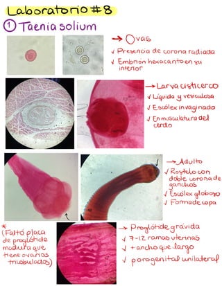 Laboratorio #8
1
Taeniasolium
-> Ovas
~Presencia de corona radiada
~Embrión hexacanto en su
interior
-> Larvacisticerco
~
Liquida y vesiculosa
~ Escolex invaginado
~En musculatura del
cerdo
↓ - >
Adulto
~Rostelo con
doble corona de
ganchos
~Escolex globoso
~Formadecopa
↑
* ->
Proglotidegravida
/Falto placa
de
proglótide v 7-12 ramas uterinas
madura que ~+
ancho quelarge
tiene ovarios
Trilobulados)
v
porogenital unilateral
 