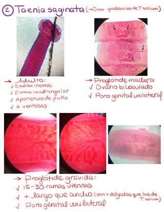 2 T
aenia saginata (Ovas:iguales a los
det.solium)
↓d
↓
-> Adulto: ->
Proglótidemadura
~Escolexinerme ~ Ovario bilobulado
~Forma cuadrangular
~ Apariencia
de puño
v poro
genital unilateral
~4 ventosas
->
Proglótide gravidas
~15-30 ramas uterinas
v +
largo que ancho (sont
delgadas que las de
T.solium)
~porogenital unilateral
 