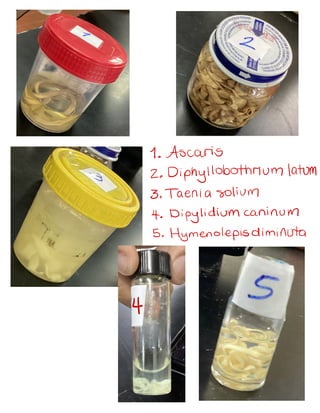1. Ascaris
2. Diphyllobothrium latum
3. T
aenia solium
4.Dipylidium caninum
5. Hymenolepis diminuta
4
 