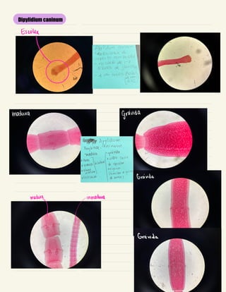 Dipylidium caninum
Escong
madura Gravida
Grávida
madura ~inmadera
Gravida
 
