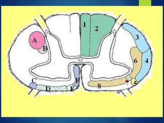 Vertebrogram traumatismo vertebro medular - Dr. Luis Gomez T. | PPTX