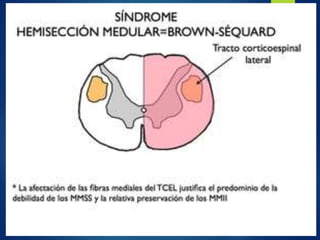 Vertebrogram traumatismo vertebro medular - Dr. Luis Gomez T. | PPTX
