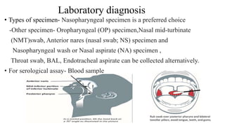 Laboratory diagnosis
• Types of specimen- Nasopharyngeal specimen is a preferred choice
-Other specimen- Oropharyngeal (OP) specimen,Nasal mid-turbinate
(NMT)swab, Anterior nares (nasal swab; NS) specimen and
Nasopharyngeal wash or Nasal aspirate (NA) specimen ,
Throat swab, BAL, Endotracheal aspirate can be collected alternatively.
• For serological assay- Blood sample
 