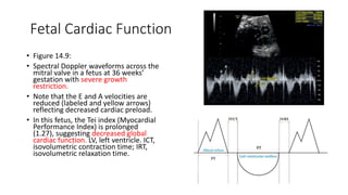 Fetal cardiac Function early detections | PPT