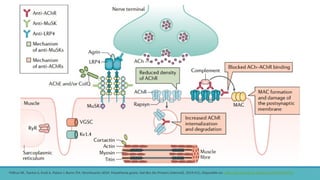 •Gilhus NE, Tzartos S, Evoli A, Palace J, Burns TM, Verschuuren JJGM. Myasthenia gravis. Nat Rev Dis Primers [Internet]. 2019;5(1). Disponible en: http://dx.doi.org/10.1038/s41572-019-0079-y
 