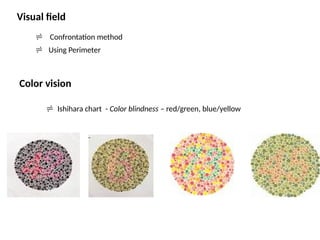  Confrontation method
 Using Perimeter
Visual field
 Ishihara chart - Color blindness – red/green, blue/yellow
Color vision
 