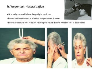 38
- Normally – sound is heard equally in each ear.
- In conductive deafness – affected ear perceives it more.
- In sensory-neural loss – better hearing ear hears it more =Weber test is lateralized
b. Weber test - lateralization
 