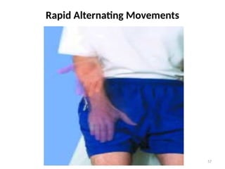 57
Rapid Alternating Movements
 