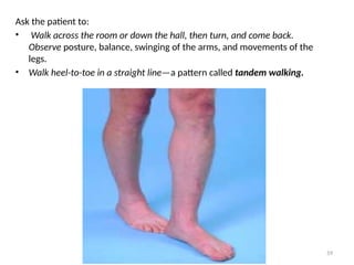 59
Ask the patient to:
• Walk across the room or down the hall, then turn, and come back.
Observe posture, balance, swinging of the arms, and movements of the
legs.
• Walk heel-to-toe in a straight line—a pattern called tandem walking.
 
