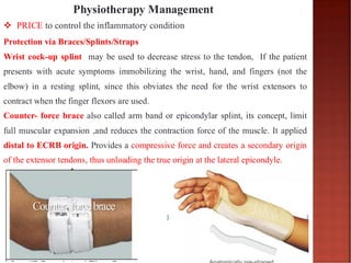 8.Elbow Epicondylitis 2025(3).pdf