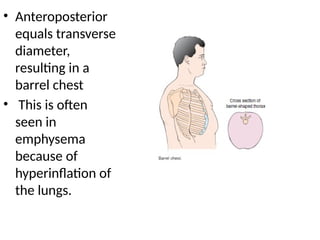 Health assessment - Thorax and lungs Nursing | PPTX