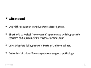 04/29/2025 41
 Ultrasound
 Use high-frequency transducers to assess nerves.
 Short axis: A typical “honeycomb” appearance with hypoechoic
fascicles and surrounding echogenic perineurium
 Long axis: Parallel hypoechoic tracts of uniform caliber.
 Distortion of this uniform appearance suggests pathology
 