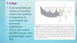 8.dental EXTRACORONAL DIRECT RETAINERS.pptx