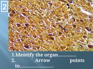 1.Identify the organ………….
2. Arrow points
to……………………
2
 