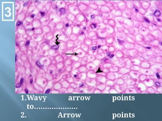 1.Wavy arrow points
to………………..
2. Arrow points
3
 