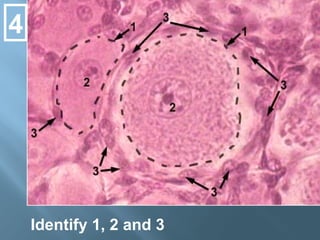 4
Identify 1, 2 and 3
 