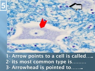 1- Arrow points to a cell is called…..
2- its most common type is………
3- Arrowhead is pointed to……..
5
 