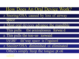 How Does An Oral Device Work?
z Snoring/OSA caused by loss of airway
space
z Most oral devices advance the mandible
This pulls the șenioșlossus forwai d
z This pulls the ton•ue ìorwaid
Uÿ]3Sl“ ílii”way space is l”egained
z Snoiin•/OSA diminished oi eliminated
Othei's simply lteep the tongue pt oti
uded
 
