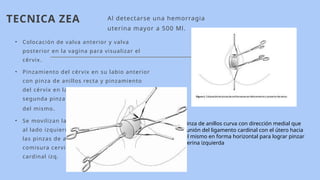 8.- ACCIDENTES DE PARTO PARTOPRESENTACION UBI.pptx