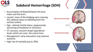HEAD TRAUMA - common presentation, types of head trauma.pptx