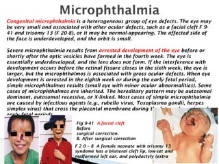 Microphthalmic anatomy eyes from what you see .pdf