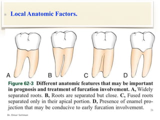 8.Furcation_compressed.pdf Periodontitis Periodontitis | PDF