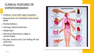 THYROID DISORDERS IN BOTH ADULTS AND CHILDREN.pdf