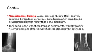 Comprehensive Overview of Bone Tumours: Diagnosis, Classification, and ...