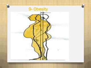 9- Obesity
 
