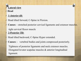 O Lateral view
O Head
O 1-Anterior tilt:
O Head tilted forward, C-Spine in Flexion.
O Causes: - stretched posterior cervical ligaments and extensor muscles.
- tight cervical flexor muscle
O 2-Posterior Tilt:
O Head tilted backward, C-Spine Hyper extended.
O Causes: - vertebral bodies and joints compressed posteriorly.
- Tightness of posterior ligaments and neck extensor muscles.
- Elongated levator scapulae muscles & anterior longitudinal
- ligament.
 