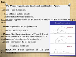 Toes:
a- Hallux valgus: Lateral deviation of great toe at MTP joint.
Causes:- joint dislocation.
- Tight adductor hallucis muscle.
- Stretched abductor hallucis muscle.
b- Claw Toe: Hyperextension of the MTP with Flexion of PIP associated with pes
cavus.
Causes:- tightness of the long toe flexors.
- shortness of the toe extensors
c- Hammer Toe: Hyperextension of MTP and DIP joint
and flexion of the PIP. Callosities under heads of MTP
joint because of excessive weight bearing there.
Causes: - shortness of the toe extensors.
- lengthened lumbricals.
d- Mallet Toe: flexion deformity of DIP joint
&extension of PIP
 