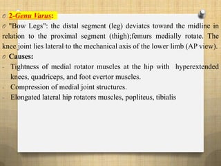 O 2-Genu Varus:
O "Bow Legs": the distal segment (leg) deviates toward the midline in
relation to the proximal segment (thigh);femurs medially rotate. The
knee joint lies lateral to the mechanical axis of the lower limb (AP view).
O Causes:
- Tightness of medial rotator muscles at the hip with hyperextended
knees, quadriceps, and foot evertor muscles.
- Compression of medial joint structures.
- Elongated lateral hip rotators muscles, popliteus, tibialis
 