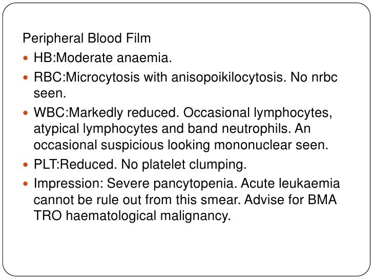 peripheral blood smear report sle 8 acute lymphoblastic leukemia peripheral blood smear report sle 8 acute lymphoblastic leukemia