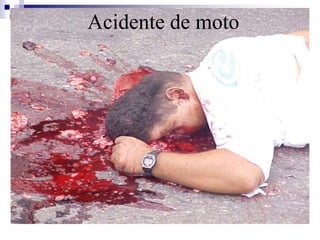 ACAIDcEiNdTeE nQtUeE DdAe D mE MoOtoTO 
 