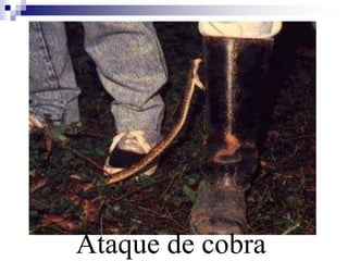 Ataque de cobra 
 