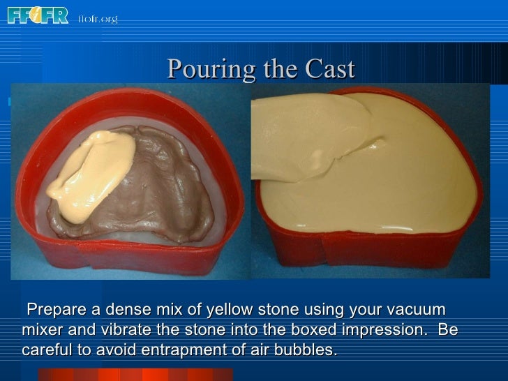 8.boxing impressions and making casts