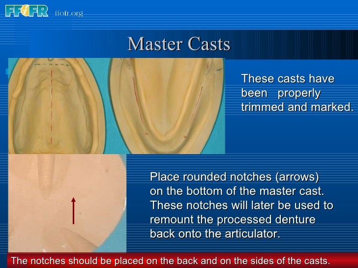 8.boxing impressions and making casts