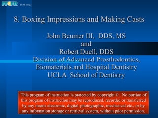8. Boxing Impressions and Making Casts John Beumer III,  DDS, MS and Robert Duell, DDS Division of Advanced Prosthodontics, Biomaterials and Hospital Dentistry UCLA  School of Dentistry This program of instruction is protected by copyright ©.  No portion of this program of instruction may be reproduced, recorded or transferred by any means electronic, digital, photographic, mechanical etc., or by any information storage or retrieval system, without prior permission. 