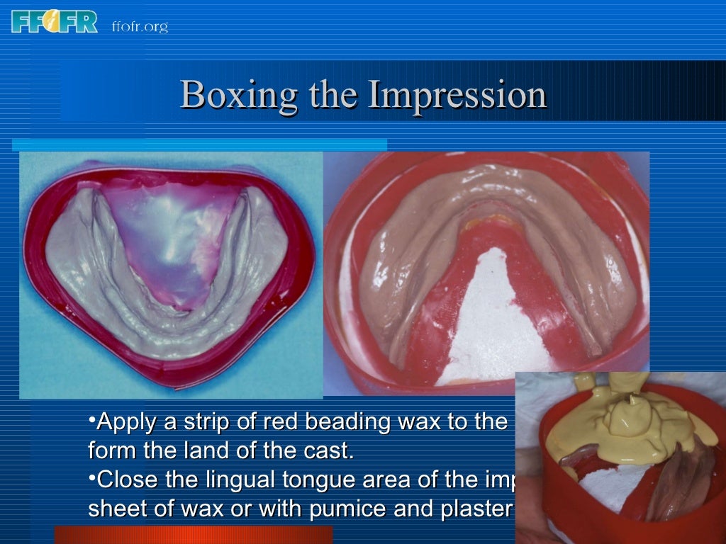 8.boxing impressions and making casts