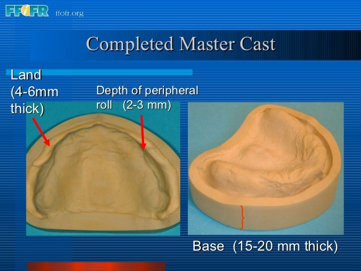 8.boxing impressions and making casts